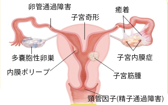 セントラルレディースクリニック 不妊症 産婦人科